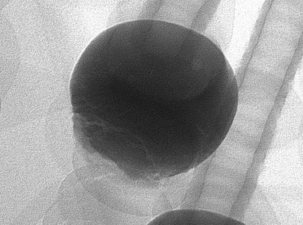 Can the X-RAY inspection machine detect defects in transparent glass materials?