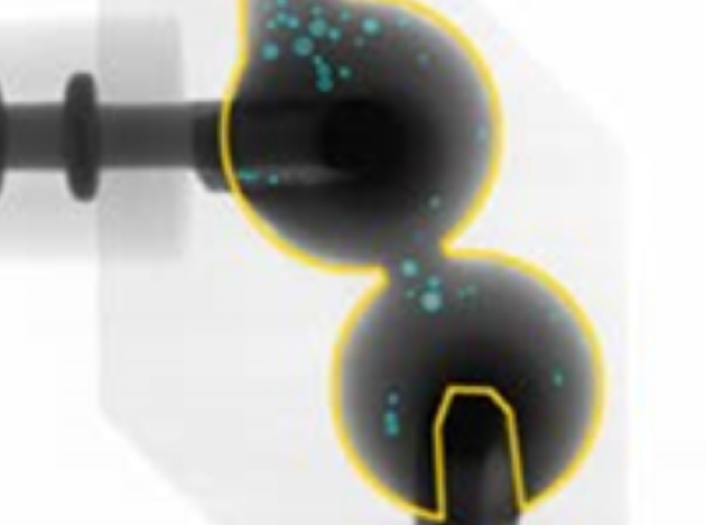 X-RAY detection of welding seam defects in mechanical parts