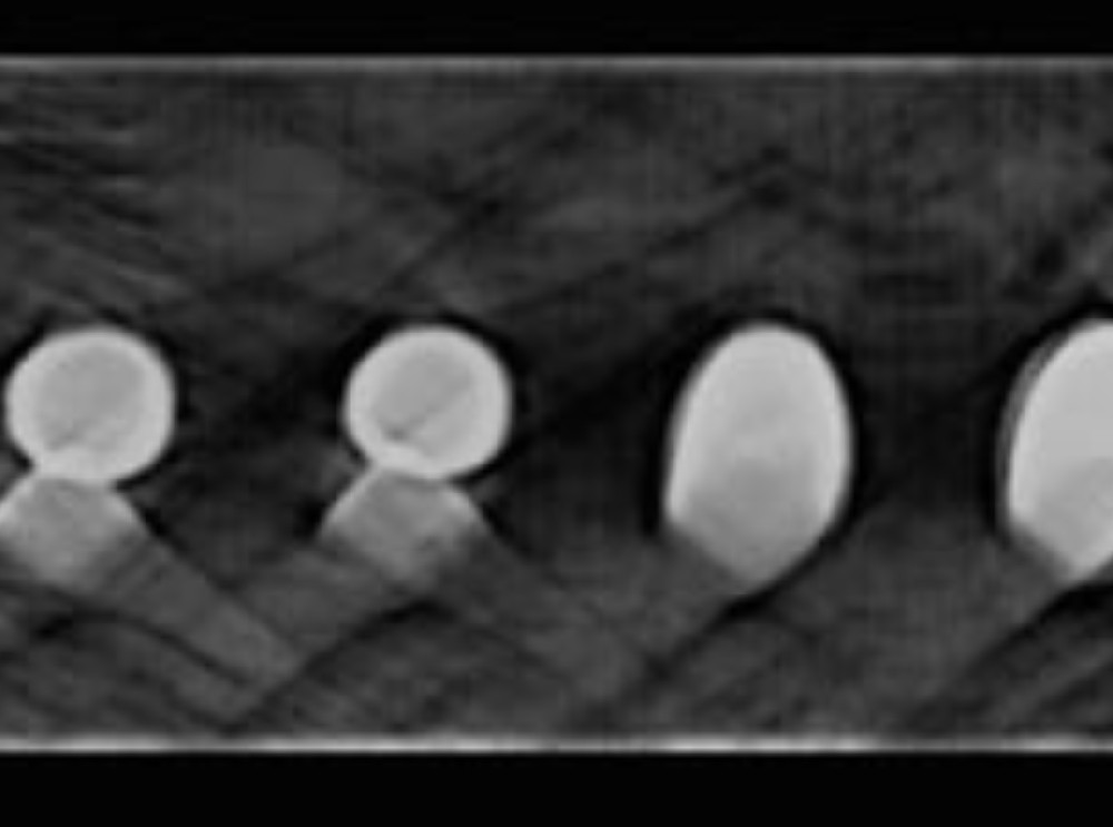 Can X-ray testing detect false soldering short circuits in the BGA soldered on the PCB?