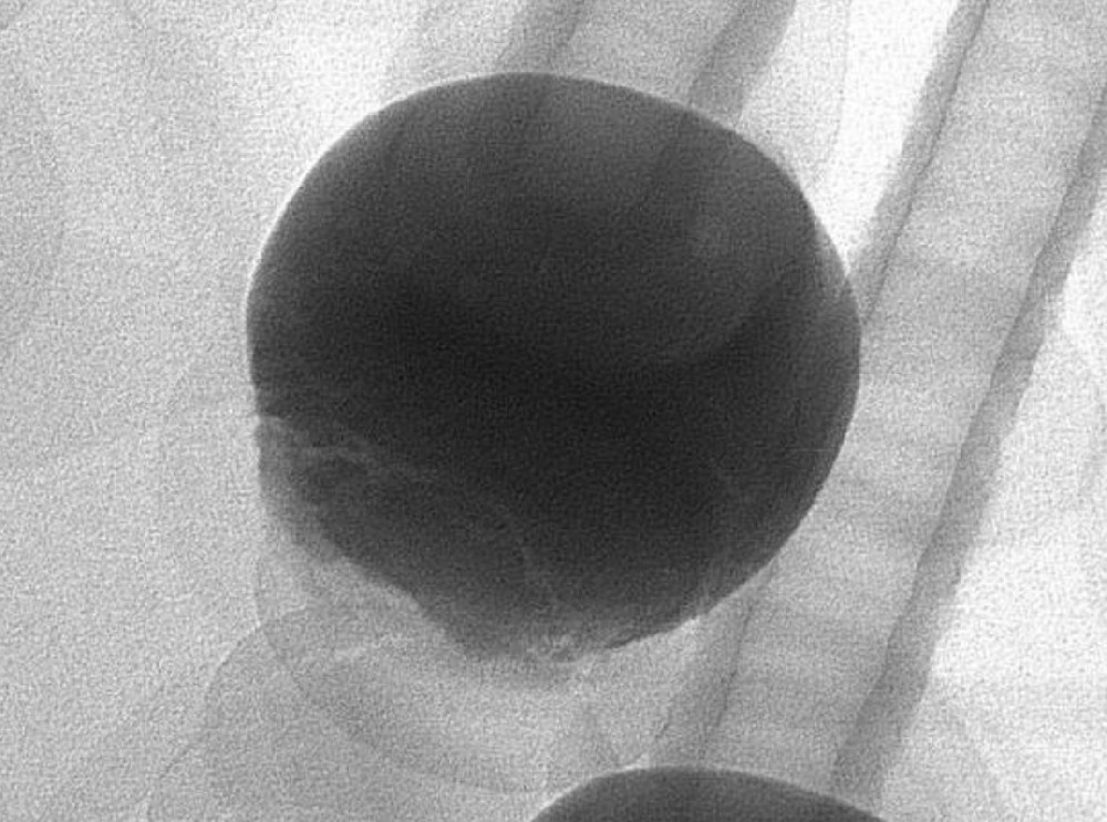 XRAY detection equipment for detecting PCBA solder joints