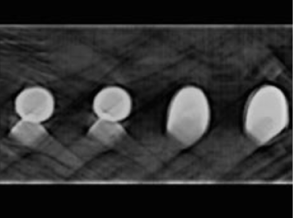 Application case of X-ray detection connector